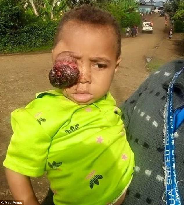 Prindërit i shkurtojnë jetën vogëlushit pasi tentuan ta kuronin me “magji të zezë”