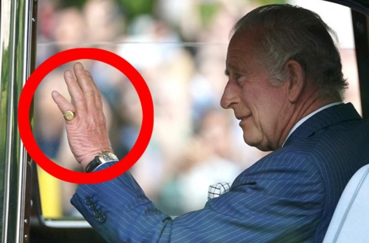 Pse Mbreti Charles III i ka gishtat e fryrë?
