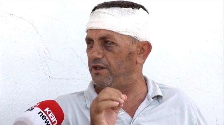 U dhunua për guroren, Jashar Maja: Policia nuk më ka marrë asnjë deklarim