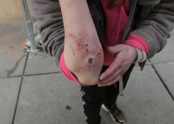 Rritja e numrit të vdekjeve nga ‘droga zombie’ në Amerikë alarmon Shtëpinë e Bardhë