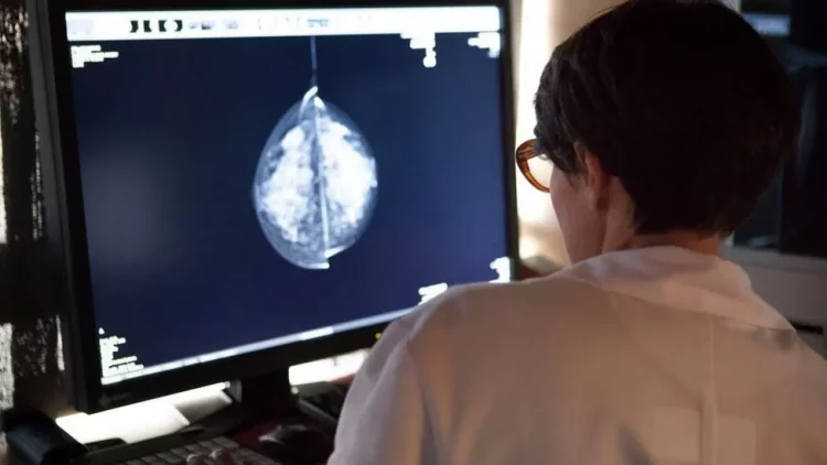 Inteligjenca artificiale ofron premtime të mëdha për ekzaminimin e kancerit të gjirit