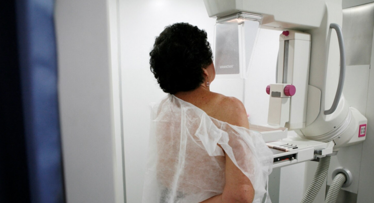 Studimi: Inteligjenca Artificiale ndihmon në diktimin e kancerit të gjirit