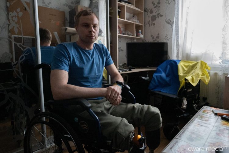 Rreth 50 mijë ukrainas kanë humbur gjymtyrët gjatë luftës