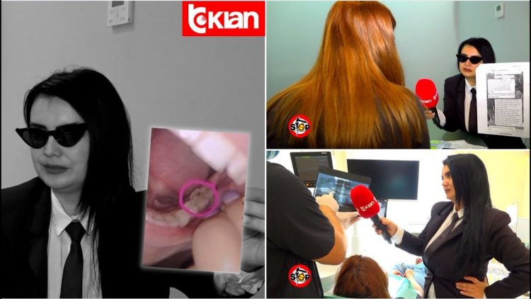 “Po kërkon llogari”, dentisti i vë këllëf mbi infeksion pa bërë grafi, pacientja detyrohet të heqë dhëmballën