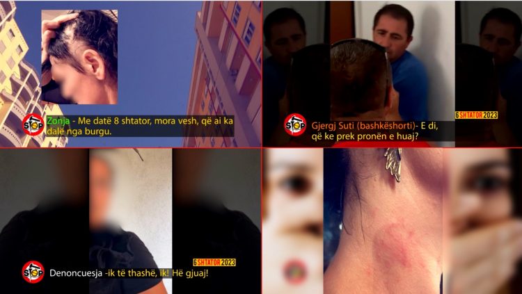 “E ka mbytur burri atë, ka pasur dëmtime cerebrale”, agresori endet i lirë pas dhunës ndaj ish-gruas