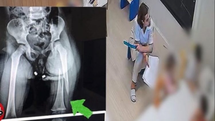 Dhunimi i 3-vjeçares në kopshtin privat, AMP dërgon në prokurori dy efektivët për “shpërdorim detyre” 