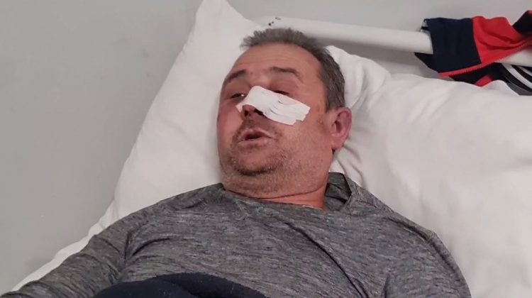 Fier/ E dhunuan grabitësit e armatosur në banesë, 54-vjeçari: Më goditën me tytën e armës në kokë