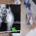 Sigurohet rehabilitimi i 3-vjeçares që i theu këmbën edukatorja