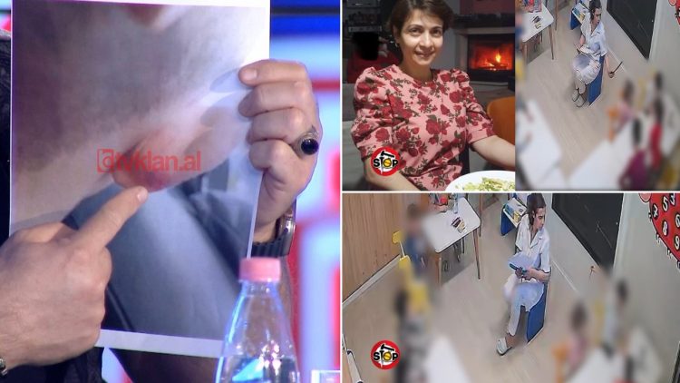 Dëshmi tjetër tronditëse për stafin e “Stinët”, nëna: Fëmijës iu mavijos veshi, më thoshte se ia ka shkulur sanitarja