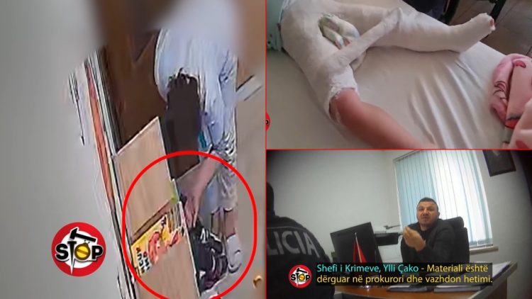 Dhuna fizike ndaj 3-vjeçares në kopshtin privat, OPGJ e mjekësia ligjore mbulojnë skandalin
