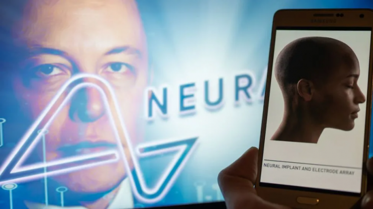 Elon Musk njofton vendosjen e parë të çipit te një njeri 