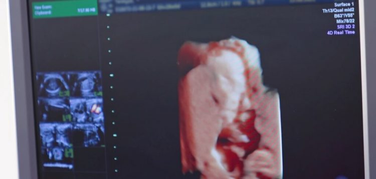Ligji i ri i hap rrugë abortit tek adoleshentet, mund të kryhet pa dijeninë e prindërve