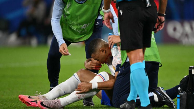 Mbappe theu hundën gjatë përballjes me Austrinë, reagon Federata Franceze: Do t’i duhet një maskë 