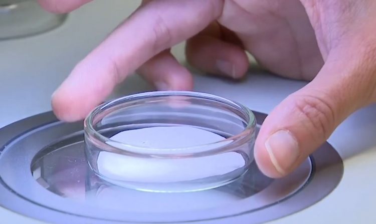 Gjenden mikroplastika në indet e njeriut 