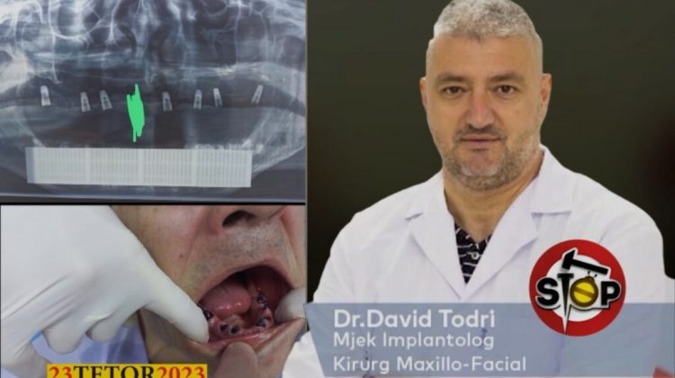 “Do të mësohesh”/Rikthehet dentisti mashtrues, qytetarja paguan 3000 euro dhe mbetet pa dhëmbë në gojë