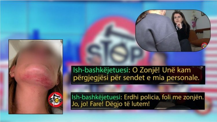 “Herën e fundit më kapi ajo për fyti”, e mitura përshkruan dhunën në familje: Kam frikë ta lë mamin vetëm