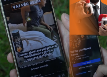 Ble online vaj për gjunjët, befasohet nga ajo që i vjen në shishe