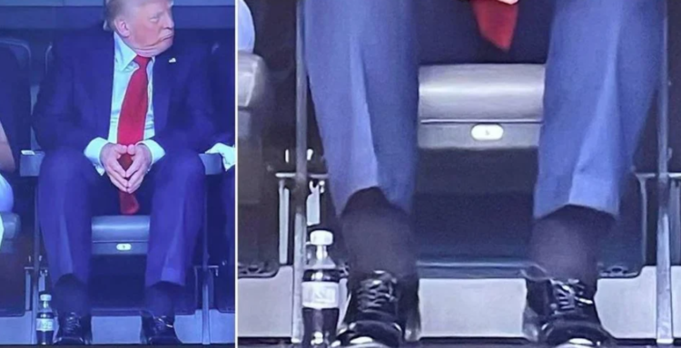 Kyçe të fryra dhe shenja në duar, ja si paraqitet gjendja shëndetësore e Trump