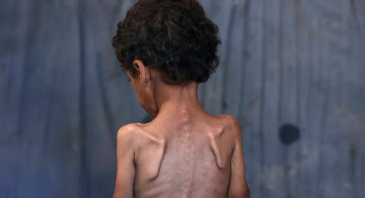 Ekspertët e krizave ushqimore: Skenari më i keq i urisë po ndodh në Gaza