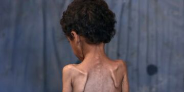 Save the Children: Fëmijët e uritur në Gazë nuk kanë forcë as të qajnë