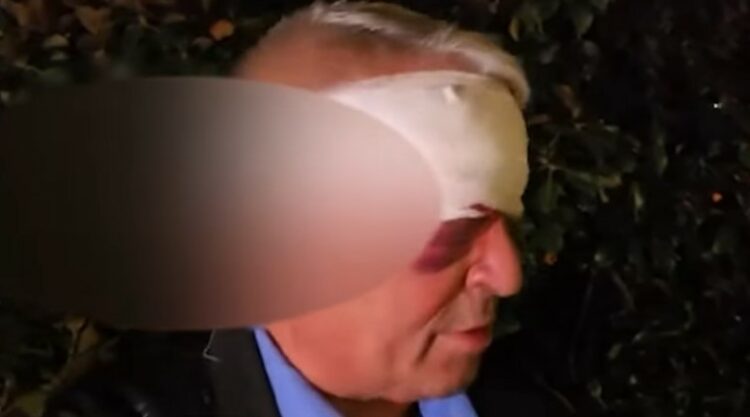 Dhunuan 61-vjeçarin/ Arrestohen dy autorët e dyshuar, rezultuan me precedentë penalë