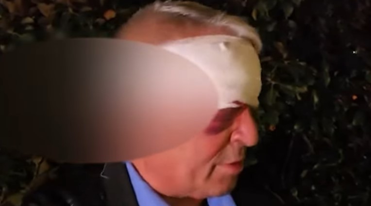 Dhunuan 61 vjeçarin  Arrestohen dy autorët e dyshuar  rezultuan me precedentë penalë