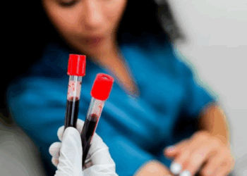 Analiza e gjakut zbulon mbi 50 lloje kanceri në fazë të hershme