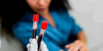 Analiza e gjakut zbulon mbi 50 lloje kanceri në fazë të hershme