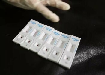 OBSH jep alarmin: Gjysma e diagnozave të HIV në Europë zbulohen shumë vonë