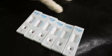 OBSH jep alarmin: Gjysma e diagnozave të HIV në Europë zbulohen shumë vonë