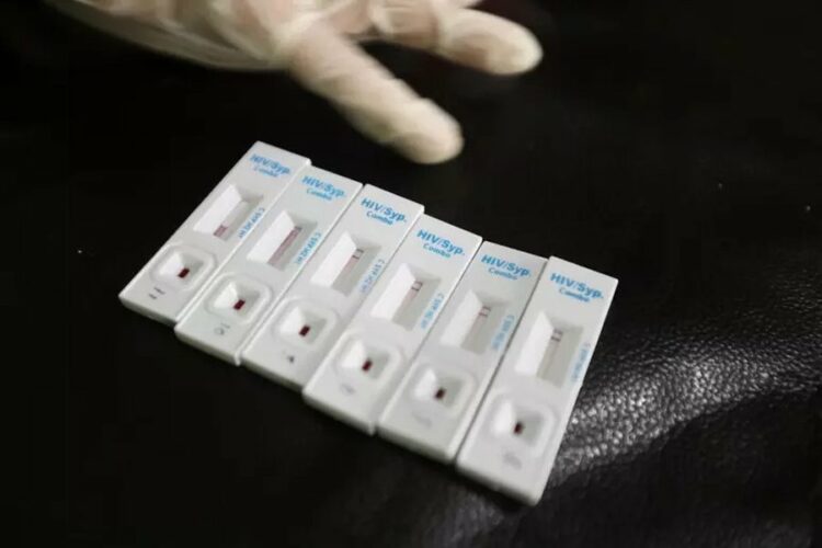 OBSH jep alarmin: Gjysma e diagnozave të HIV në Europë zbulohen shumë vonë