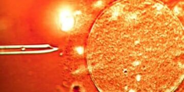 BBC: Në Shqipëri dhe 13 shtete të tjera u përdor sperma nga një dhurues me…