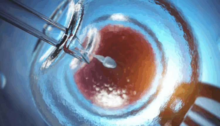 Si u shpërnda në mbarë Europën një gjen kanceri i rrallë?