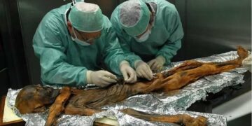 Zbulohet se mumia Ötzi ishte e infektuar me papilloma virus