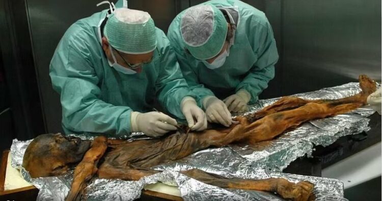 Zbulohet se mumia Ötzi ishte e infektuar me papilloma virus