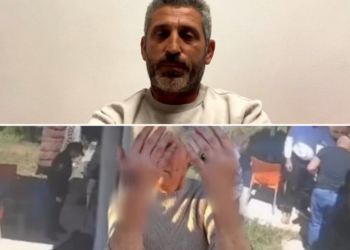 “Nona ime s’ka dhëmbë, këta thonë ka kafshuar policët”, çfarë ndodhi në Golem