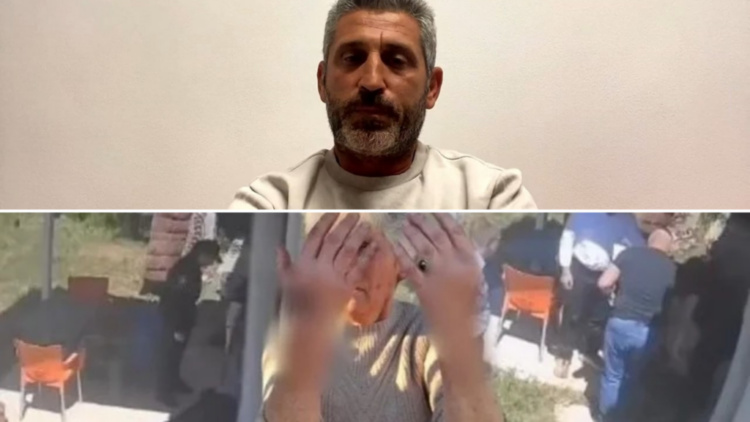 “Nona ime s’ka dhëmbë, këta thonë ka kafshuar policët”, çfarë ndodhi në Golem
