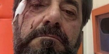 Dhunohet analisti Ilir Demalia