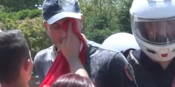 Protestuesi i pastroi fytyrën policit, Balla: Si mund të përdoret flamuri si peshqir